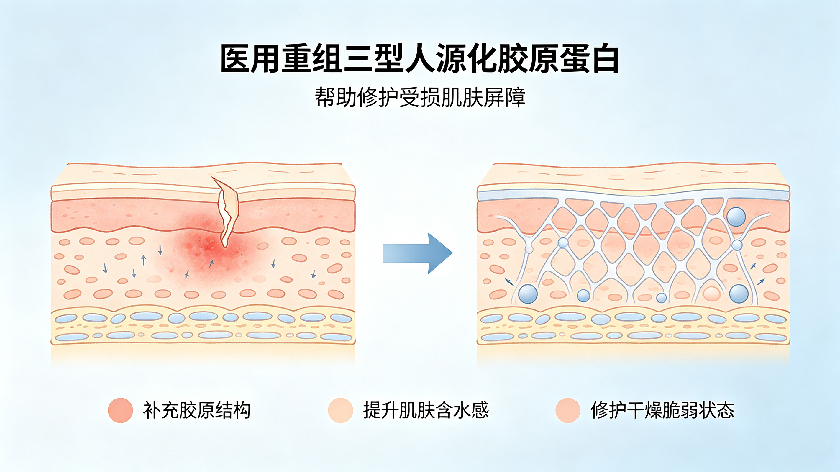 医用重组三型人源化胶原蛋白科普 (2)